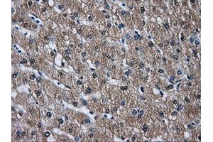 Immunohistochemical staining of paraffin-embedded liver tissue using anti-DCXRmouse monoclonal antibody. (DCXR antibody)