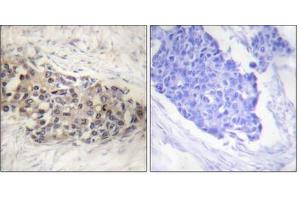 Immunohistochemistry analysis of paraffin-embedded human brain tissue using SF1 (epitope around residue 82) antibody. (Splicing Factor 1 antibody  (Ser82))