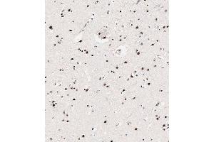 Immunohistochemical analysis of paraffin-embedded Human brain tissue using (ABIN650833 and ABIN2839800) performed on the Leica® BOND RXm. (MECP2 antibody  (pSer423))