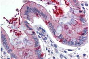 Human Colon (formalin-fixed, paraffin-embedded) stained with LIN7C antibody ABIN462236 followed by biotinylated goat anti-rabbit IgG secondary antibody ABIN481713, alkaline phosphatase-streptavidin and chromogen. (LIN7C antibody  (N-Term))
