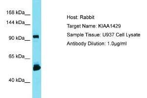 Host: Rabbit Target Name: KIAA1429 Sample Type: U937 Whole Cell lysates Antibody Dilution: 1. (VIRMA/KIAA1429 antibody  (C-Term))