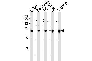 Western blot analysis of lysates from , mouse Neuro-2a, rat PC-12, C6 cell line and mouse brain tissue lysate(from left to right), using UCHL1 Antibody (ABIN1539817 and ABIN2843804). (UCHL1 antibody)