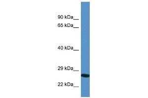 Western Blot showing YIPF4 antibody used at a concentration of 1.