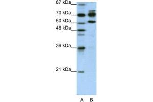 Western Blotting (WB) image for anti-Adenosine Deaminase, RNA-Specific, B1 (ADARB1) antibody (ABIN2462101) (RED1 antibody)