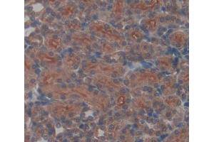 Used in DAB staining on fromalin fixed paraffin- embedded kidney tissue (UQCRB antibody  (AA 4-111))