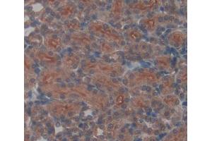 Used in DAB staining on fromalin fixed paraffin- embedded kidney tissue (UQCRB antibody  (AA 4-111))