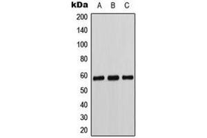 Western blot analysis of Cytochrome P450 11B1/2 expression in K562 (A), Caki1 (B), MCF7 (C) whole cell lysates. (Cytochrome P450 11B1/2 (N-Term) antibody)