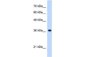 C19ORF47 antibody used at 0. (C19orf47 antibody  (C-Term))