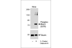 Western blot analysis of lysates from Hela cell line, untreated or treated with IL-1 beta(20 ng/mL) + Calyculin A(100nM), using (ABIN6241064 and ABIN6578961) (upper) or Tubulin (lower). (IRAK1 antibody  (pSer376))