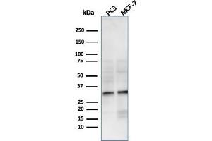 Western Blot Analysis of PC3 and MCF-7 cell lysate using NKX2. (Recombinant NKX2-8 antibody  (AA 10-123))