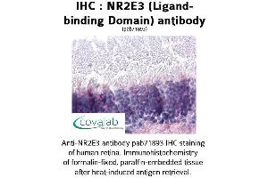 Image no. 1 for anti-Nuclear Receptor Subfamily 2, Group E, Member 3 (NR2E3) antibody (ABIN1737507)