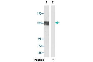 Western blot analysis of extracts from Jurkat cells, using GRIN1 polyclonal antibody .