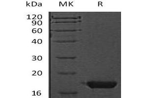 Western Blotting (WB) image for Cystatin F (Leukocystatin) (CST7) protein (His tag) (ABIN7320507) (CST7 Protein (His tag))