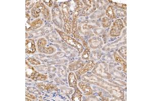 Immunohistochemistry of paraffin-embedded mouse kidney using Sterol carrier protein 2 Rabbit mAb (ABIN7270597) at dilution of 1:100 (40x lens).