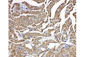 IHC-P: Troponin C antibody testing of rat heart tissue (TNNC1 antibody  (N-Term))
