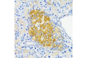 Immunohistochemistry of paraffin-embedded rat islets of langerhans using CCND1 antibody. (Cyclin D1 antibody  (C-Term))
