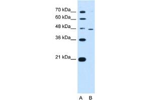 WB Suggested Anti-RNF25 Antibody Titration:  0. (RNF25 antibody  (Middle Region))