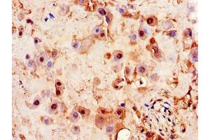 Immunohistochemistry of paraffin-embedded human placenta tissue using ABIN7163469 at dilution of 1:100 (PITX3 antibody  (AA 10-200))