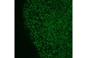 Immunofluorescence analysis of human iPS cells using NANOG antibody (green). (Nanog antibody  (AA 20-166))