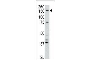 Image no. 1 for anti-ATP-Binding Cassette, Sub-Family B (MDR/TAP), Member 4 (ABCB4) (Center) antibody (ABIN358591) (ABCB4 antibody  (Center))