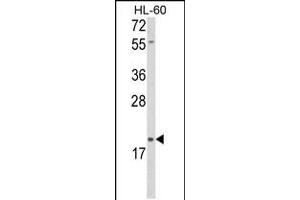 Western blot analysis of DLK2 Antibody in HL-60 cell line lysates (35ug/lane) (DLK2 antibody  (C-Term))