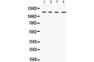 Western blot analysis of UBA1 expression in rat liver extract (lane 1), mouse liver extract (lane 2), mouse testis extract (lane 3) and HELA whole cell lysates (lane 4).