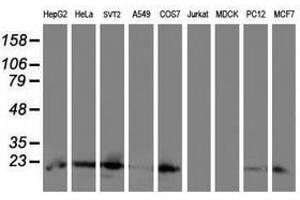 Image no. 2 for anti-Ubiquitin-Conjugating Enzyme E2E 3 (UBE2E3) antibody (ABIN1501628) (UBE2E3 antibody)