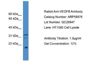 WB Suggested Anti-VEGFB  Antibody Titration: 0. (VEGFB antibody  (C-Term))