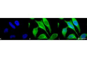 Immunocytochemistry/Immunofluorescence analysis using Rabbit Anti-p70 S6K Polyclonal Antibody .