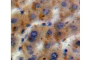 #VALUE! (GLN1 antibody  (AA 1-373))