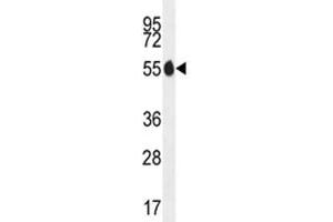 PAX1 antibody western blot analysis in MDA-MB435 lysate. (PAX1 antibody  (AA 163-189))