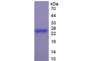 SDS-PAGE of Protein Standard from the Kit (Highly purified E. (PTF1A ELISA Kit)