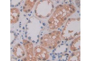 Used in DAB staining on fromalin fixed paraffin- embedded kidney tissue (ABCA9 antibody  (AA 1423-1590))