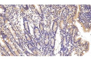 Detection of FAS in Porcine Small intestine Tissue using Polyclonal Antibody to Factor Related Apoptosis (FAS) (FAS antibody)
