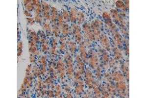 Used in DAB staining on fromalin fixed paraffin- embedded stomach tissue (AGRN antibody  (AA 1206-1475))