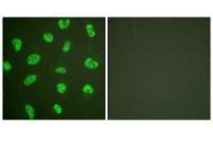Immunofluorescence analysis of HeLa cells, treated with Forskolin (40nM, 30 mins), using DNA-PK antibody.