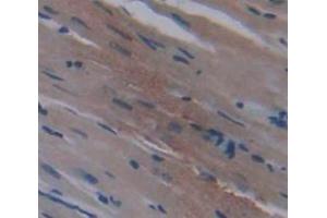 Used in DAB staining on fromalin fixed paraffin- embedded Kidney tissue (METRN antibody  (AA 22-291))