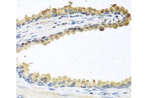 Immunohistochemistry of paraffin-embedded Human prostate using COCH Polyclonal Antibody at dilution of 1:100 (40x lens). (COCH antibody)