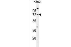 Western Blotting (WB) image for anti-Sphingomyelin phosphodiesterase 1, Acid Lysosomal (SMPD1) antibody (ABIN2996601)