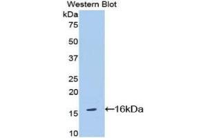 Western Blotting (WB) image for anti-Interleukin 18 Receptor 1 (IL18R1) (AA 391-518) antibody (ABIN1174881)