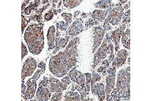 IHC analysis of MUT using anti-MUT antibody (ABIN4886676). (MUT antibody  (N-Term))