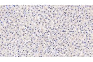 Detection of MT1 in Rat Liver Tissue using Polyclonal Antibody to Metallothionein 1 (MT1) (MT1 antibody  (AA 1-61))