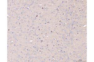 IHC analysis of MT-CO2 using anti-MT-CO2 antibody (ABIN7599081).