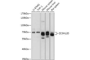ZC3H12D antibody  (AA 150-230)