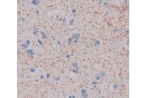 Used in DAB staining on fromalin fixed paraffin- embedded Kidney tissue (CDH23 antibody  (AA 34-236))