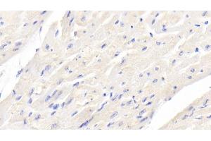Detection of BMP3 in Bovine Cardiac Muscle Tissue using Monoclonal Antibody to Bone Morphogenetic Protein 3 (BMP3) (BMP3 antibody  (AA 313-471))