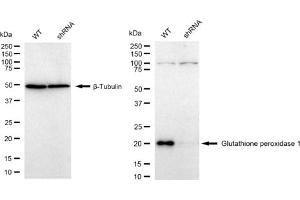 Western blotting analysis using Glutathione peroxidase 1 antibody (ABIN7798752).
