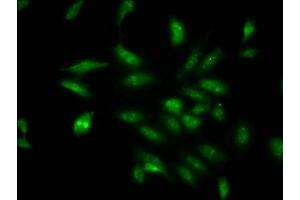 Immunofluorescence staining of Hela cells with ABIN7164337 at 1:100, counter-stained with DAPI. (DDX17 antibody  (AA 591-692))