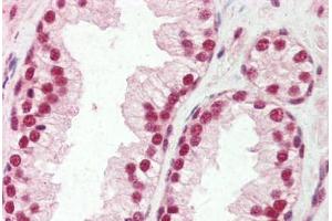 Human Prostate (formalin-fixed, paraffin-embedded) stained with SNRPA antibody ABIN462227 followed by biotinylated goat anti-rabbit IgG secondary antibody ABIN481713, alkaline phosphatase-streptavidin and chromogen. (SNRPA1 antibody  (AA 191-240))