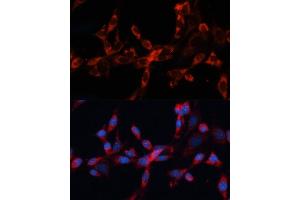 Immunofluorescence analysis of NIH/3T3 cells using Cathepsin L/V/K/H antibody (ABIN6127670, ABIN6139235, ABIN6139237 and ABIN6215636) at dilution of 1:100. (Cathepsin L antibody  (AA 114-333))